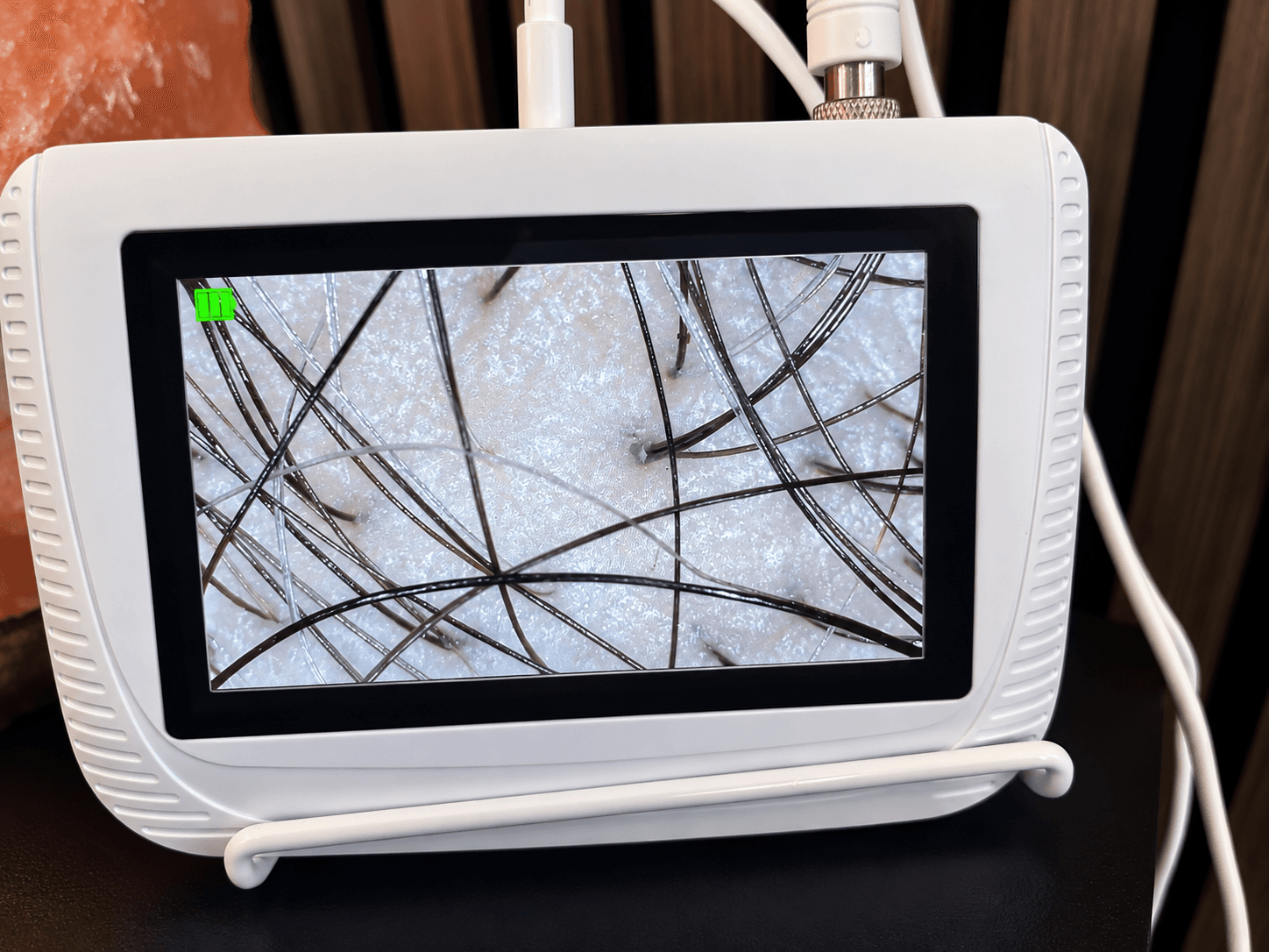 Scalp analysis monitor at Cloud 9 Head Spa